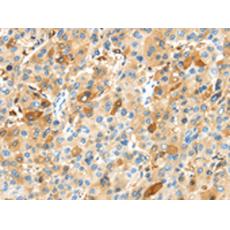 兔抗MAP3K10多克隆抗體