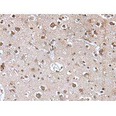 兔抗TRIM27多克隆抗體