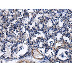 兔抗NAA60多克隆抗體