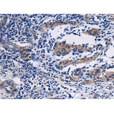 兔抗NAA60多克隆抗體