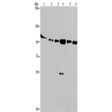 兔抗PRKD3多克隆抗體