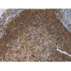 兔抗PRKD3多克隆抗體