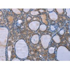 兔抗OPTN多克隆抗體