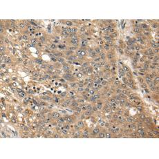 兔抗PTK7多克隆抗體