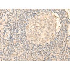 兔抗NOLC1多克隆抗體