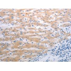 兔抗PAK1多克隆抗體