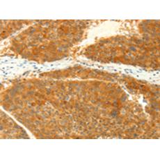 兔抗NAPA多克隆抗體