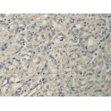 兔抗PPM1A多克隆抗體