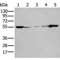 兔抗PFKFB3多克隆抗體