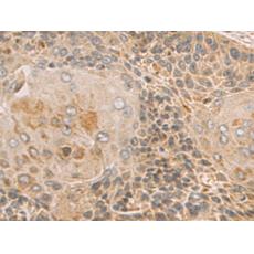 兔抗PDCD1LG2多克隆抗體