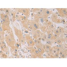 兔抗PDCD1LG2多克隆抗體