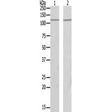 兔抗POLR1B多克隆抗體
