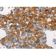 兔抗MUC5B多克隆抗體