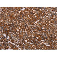 兔抗MFAP5多克隆抗體