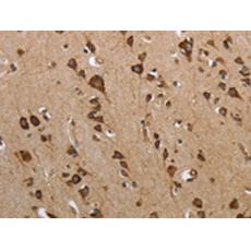 兔抗MYH11多克隆抗體