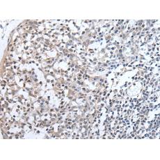 兔抗PLAG1多克隆抗體