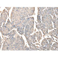 兔抗PRSS38多克隆抗體