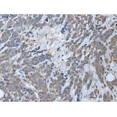 兔抗MYF6多克隆抗體