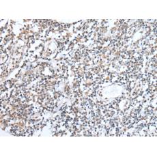 兔抗MEF2A多克隆抗體