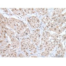 兔抗MEF2A多克隆抗體