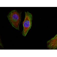 兔抗MAPK1 MAPK3 (Phospho-Thr185 202)多克隆抗體