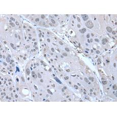 兔抗SERTAD1多克隆抗體?