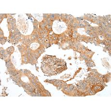 兔抗SDC2多克隆抗體  