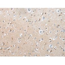 兔抗SDC2多克隆抗體  