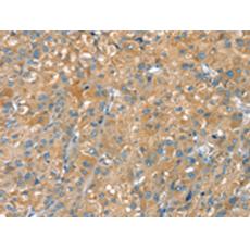  兔抗PTPRN多克隆抗體 