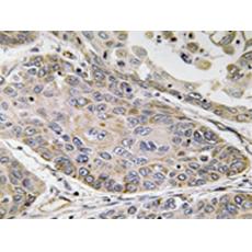 兔抗PLA2G4E多克隆抗體