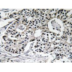 兔抗PXMP2多克隆抗體 