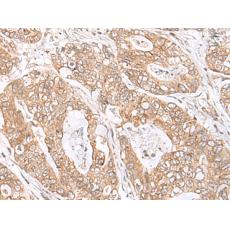 兔抗SEC11A多克隆抗體   