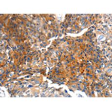 兔抗MTNR1A多克隆抗體