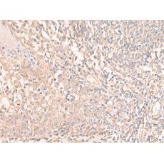 兔抗TMEM45A多克隆抗體