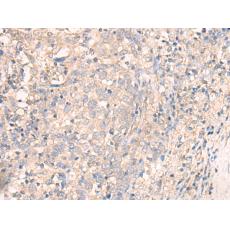 兔抗TMEM45A多克隆抗體