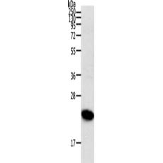 兔抗RHOC多克隆抗體  