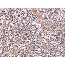 兔抗MGP多克隆抗體