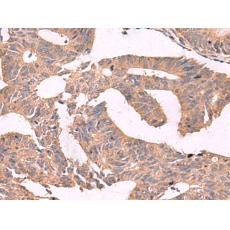 兔抗MGP多克隆抗體