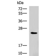 兔抗RAB38多克隆抗體  