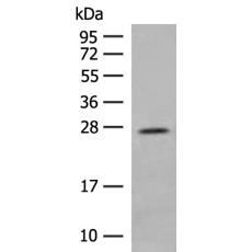 兔抗MDFI多克隆抗體