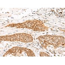 兔抗MDFI多克隆抗體