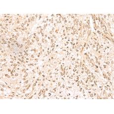 兔抗MDFI多克隆抗體