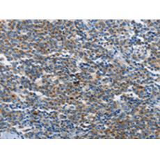 兔抗NEK1多克隆抗體