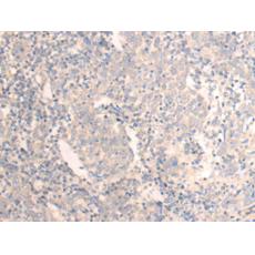 兔抗SAMM50多克隆抗體 