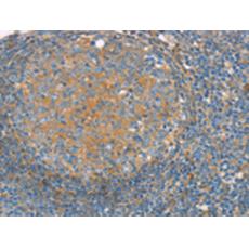 兔抗SNX3多克隆抗體