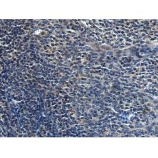 兔抗HAUS6多克隆抗體 