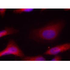 兔抗SRC (Phospho-Tyr529)多克隆抗體