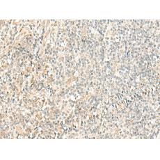 兔抗RPP14多克隆抗體