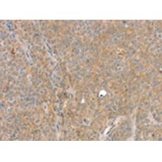 兔抗SLC8A3多克隆抗體 