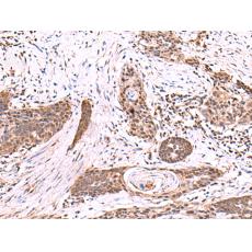 兔抗SCCPDH多克隆抗體    